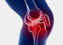 Симптомы разрыва и лечение мениска коленного сустава